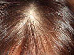 ���̖т�L�΂����Ƃ���